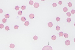 Infectious agents (blood)