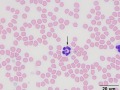 Anaplasma phagocytophilum (feline)