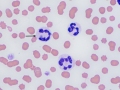 Anaplasma phagocytophilum (feline)