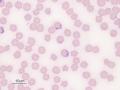 Babesia (reindeer)
