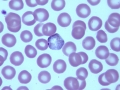 Plasmodium (primate)