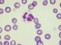 Distemper (DQ)