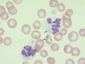 Distemper (Wrights)