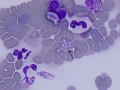 Babesia canis