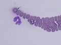 Babesia canis