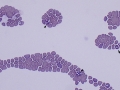 Babesia canis