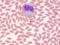 Mycoplasma haemolamae
