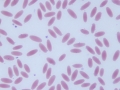 Mycoplasma haemolamae