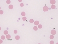 Anaplasma marginale