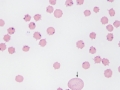 Anaplasma marginale