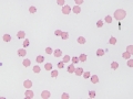 Anaplasma marginale