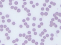 Cytauxzoon