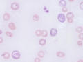 Babesia gibsoni