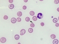 Babesia gibsoni