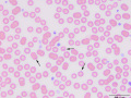 Babesia (fox)