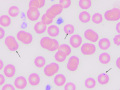 Babesia (fox)