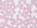 Babesia canis