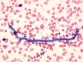 Microfilaria (coyote)