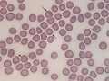 Cytauxzoon