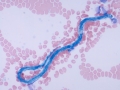 Microfilaria