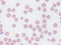 Eperythrozoon wenyonii