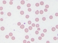 Eperythrozoon wenyonii