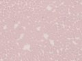 Babesia (elk)