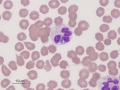 Anaplasma phagocytophilum (canine)