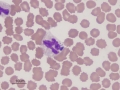 Anaplasma phagocytophilum (canine)