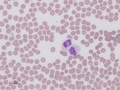 Anaplasma phagocytophilum (canine)