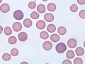Mycoplasma haemofelis