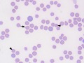 Mycoplasma haemofelis