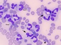 Histoplasma