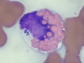 Anaplasma phagocytophilum (equine)