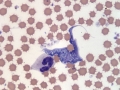 Trypanosome (bovine)
