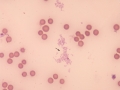 Mycoplasma haemofelis