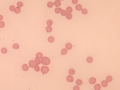 Mycoplasma haemofelis