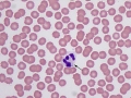 Anaplasma/Ehrlichia (canine)