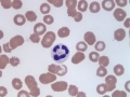Mycobacteria