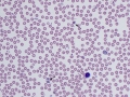 Plasmodium berghei (murine)