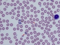 Plasmodium berghei (murine)