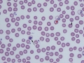Plasmodium berghei (murine)