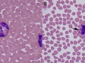 Anaplasma (reindeer)