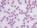 Bartonella