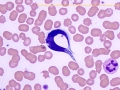 Trypanosome (beaver)