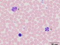 Leukocytes