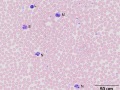 Leukocytes