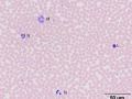 Leukocytes