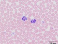 Neutrophils