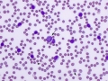CLL (dog, DQ)